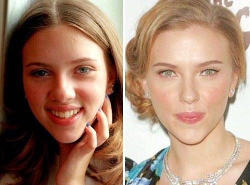 Scarlett Johansson_prima e dopo
