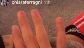 Anche Fedez indossa l'anello di matrimonio la foto di Chiara Ferragni