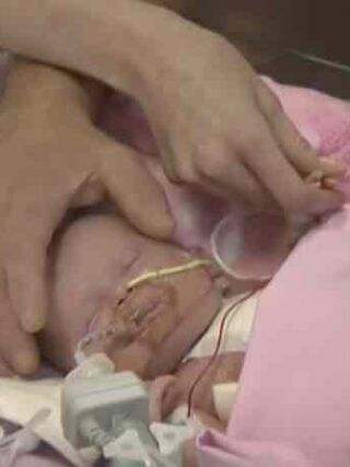 Bambina nata con il cuore fuori dal corpo, ora sta bene