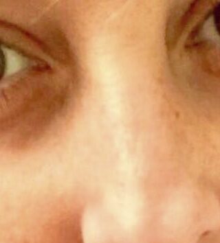 Nadia Toffa e la foto che ci fa preoccupare per la sua salute