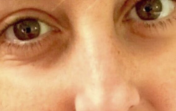 Nadia Toffa e la foto che ci fa preoccupare per la sua salute