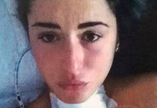 VALENTINA VIGNALI CANCRO TIROIDE