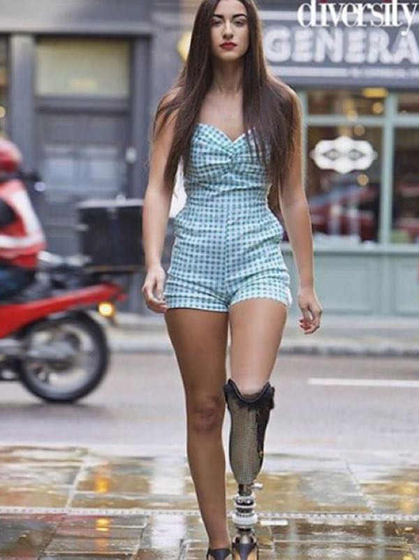 Miss Italia finale Chiara Bordi la miss con la protesi al piedi insultata e odiata sui social