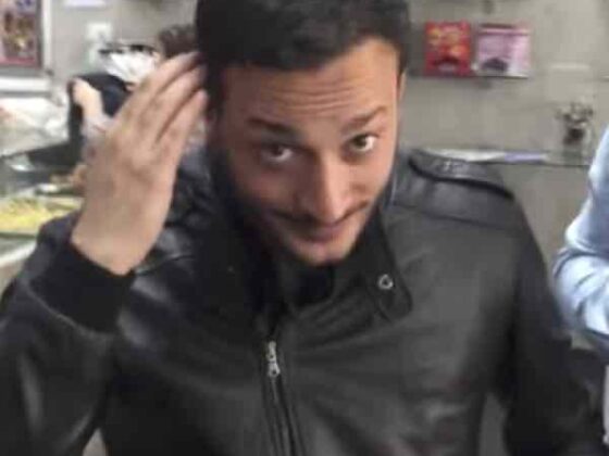 Trapianto di capelli e di barba in Turchia quanto costa? Ecco tutto quello che c'è da sapere