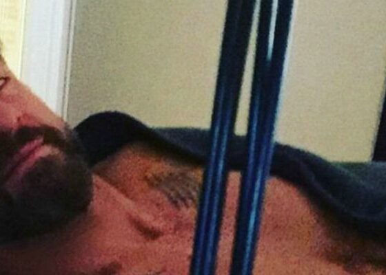 Edoardo Stoppa accoltellato Striscia la notizia racconta cos'è successo