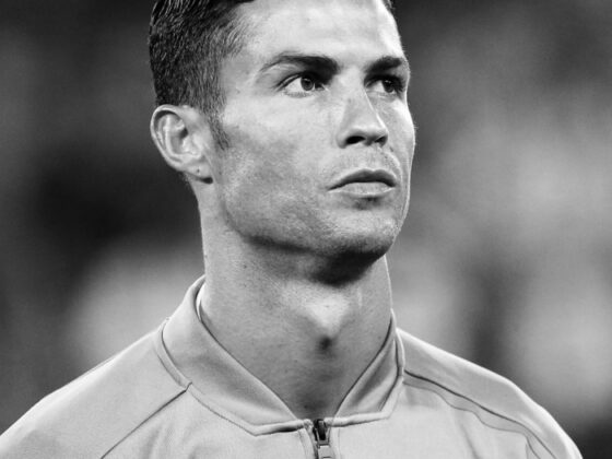 Cristiano Ronaldo apre la clinica per il trapianto di capelli e contro la caduta dei capelli